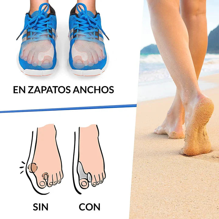Corrector de Juanetes Ortopédico- Hallux™ (1 par) + Envio Gratis