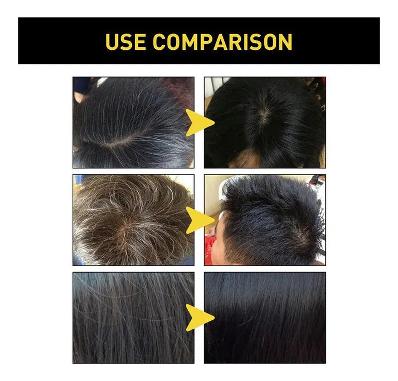 Shampoo Disaar Unisex 400ml – Cubre Canas en minutos, Sin Químicos.