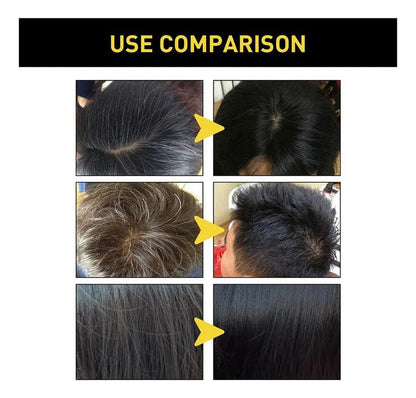 Shampoo Disaar Unisex 400ml – Cubre Canas en minutos, Sin Químicos.