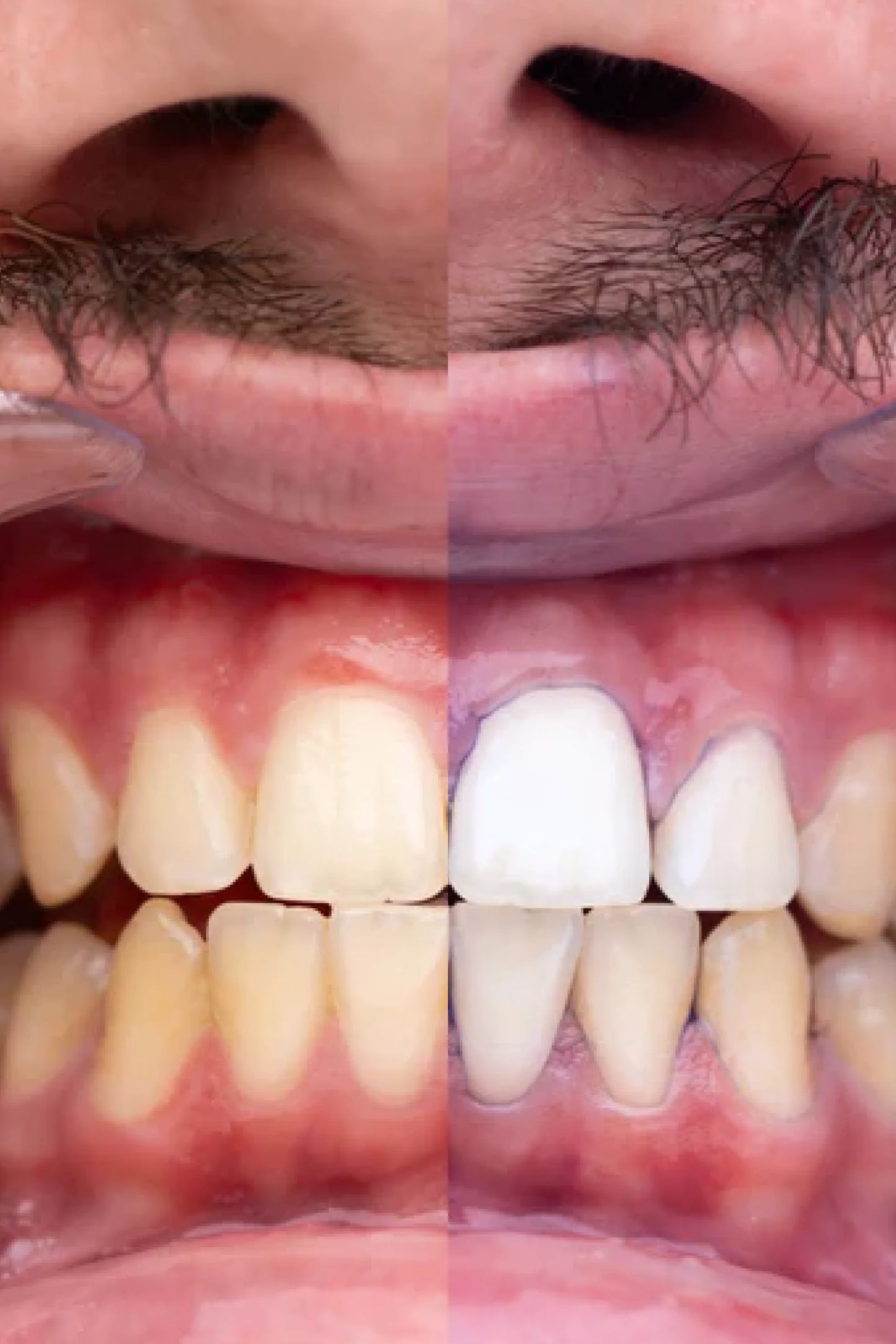 OBSESSIVE® | Pasta dental blanqueadora
